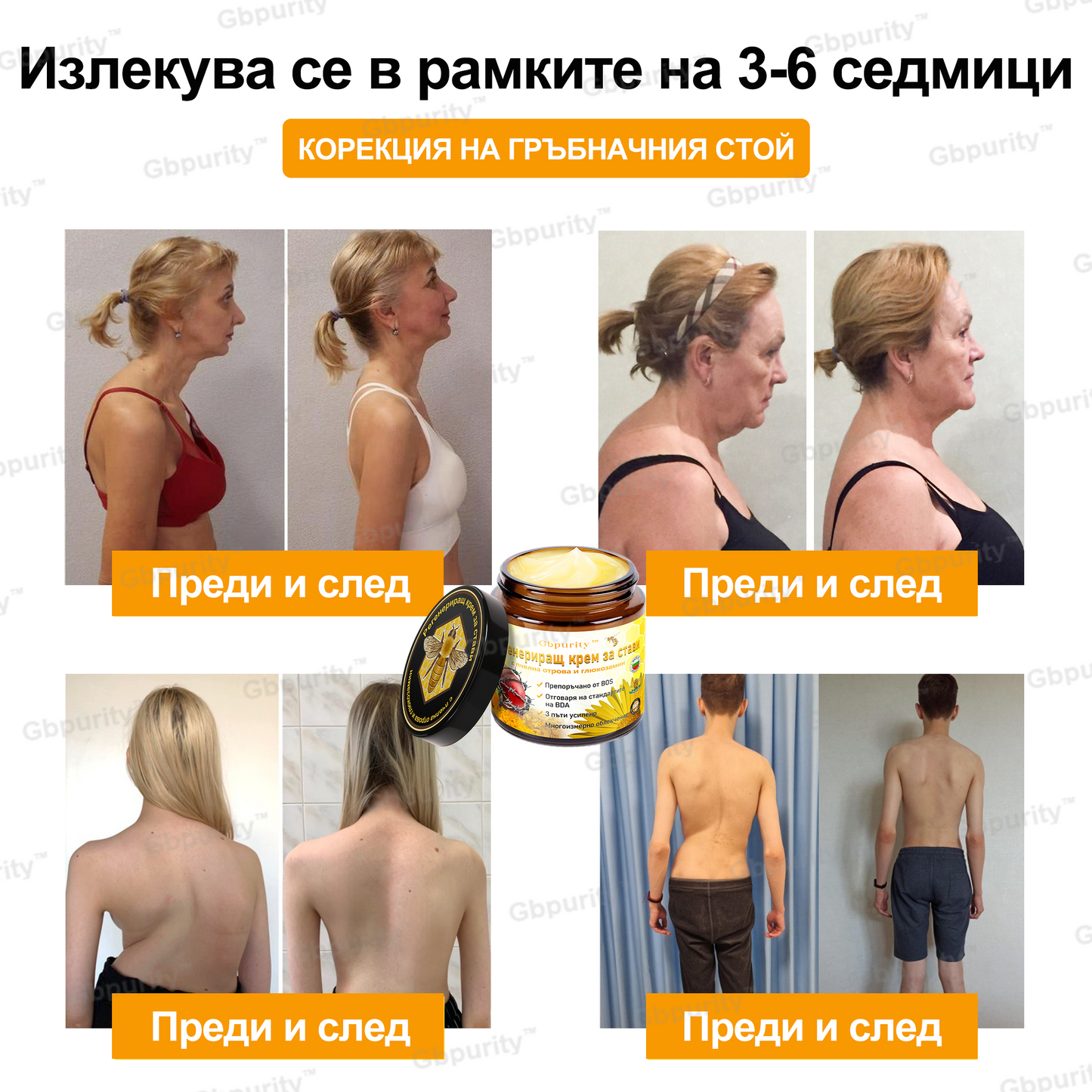 🦴𝑮𝒃𝒑𝒖𝒓𝒊𝒕𝒚™ Регенериращ крем за стави с пчелна отрова и глюкозамин — Препоръчан от водещи специалисти от Българската асоциация по ортопедия и травматология