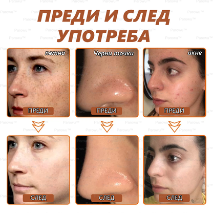 Parowu™ Изсветляваща и премахваща петна маска (✨Натурални съставки за дълготрайно премахване на петна, хиперпигментации и слънчеви петна)