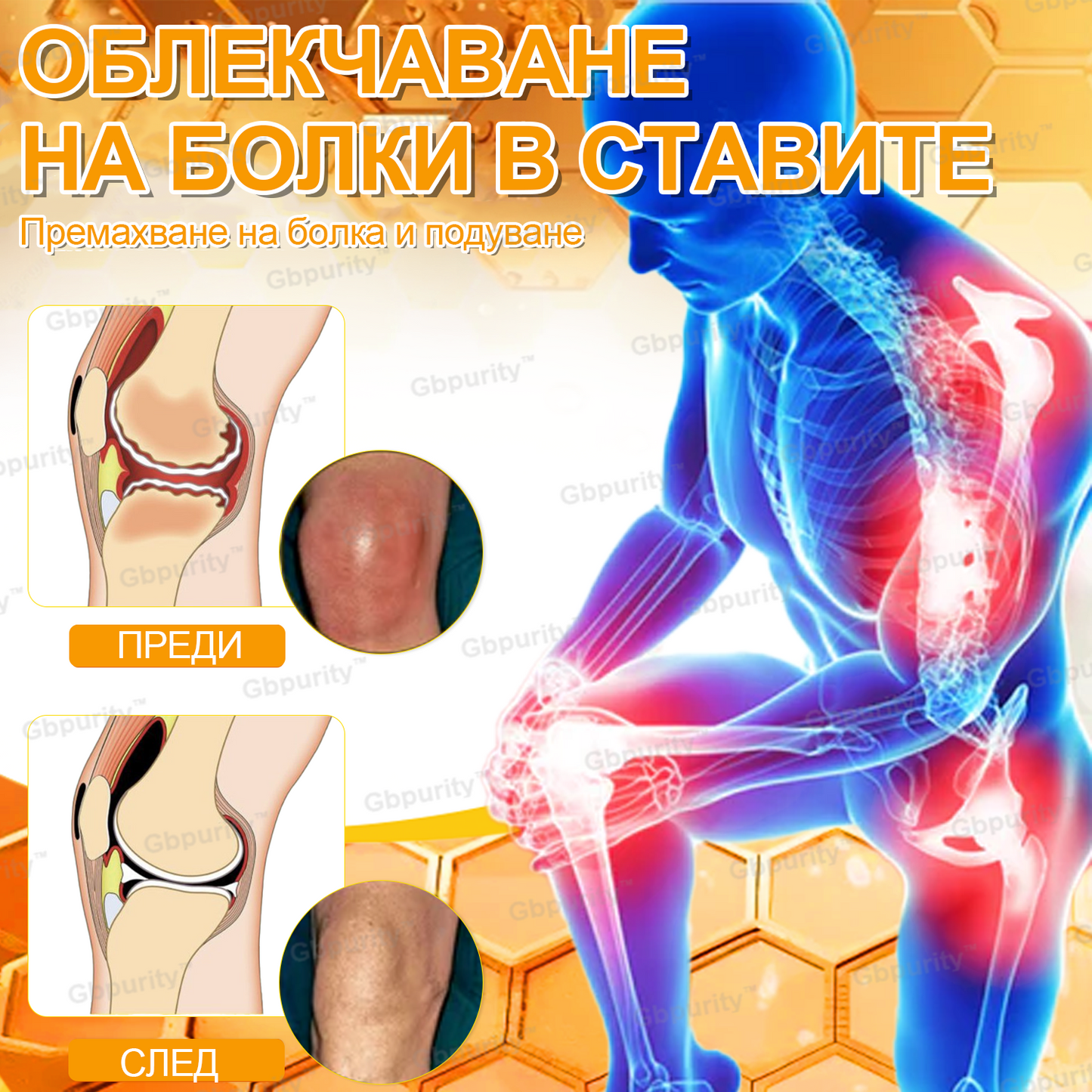 🦴𝑮𝒃𝒑𝒖𝒓𝒊𝒕𝒚™ Регенериращ крем за стави с пчелна отрова и глюкозамин — Препоръчан от водещи специалисти от Българската асоциация по ортопедия и травматология