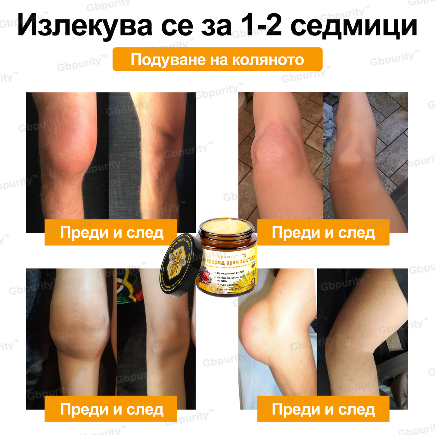 🦴𝑮𝒃𝒑𝒖𝒓𝒊𝒕𝒚™ Регенериращ крем за стави с пчелна отрова и глюкозамин — Препоръчан от водещи специалисти от Българската асоциация по ортопедия и травматология