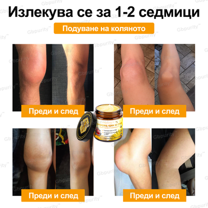 🦴𝑮𝒃𝒑𝒖𝒓𝒊𝒕𝒚™ Регенериращ крем за стави с пчелна отрова и глюкозамин — Препоръчан от водещи специалисти от Българската асоциация по ортопедия и травматология