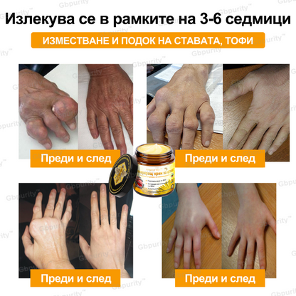 🦴𝑮𝒃𝒑𝒖𝒓𝒊𝒕𝒚™ Регенериращ крем за стави с пчелна отрова и глюкозамин — Препоръчан от водещи специалисти от Българската асоциация по ортопедия и травматология