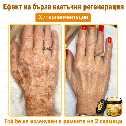 REHELY® Крем с пчелна отрова за регенерация на кожата – Подходящ за всички възрасти и типове кожа)