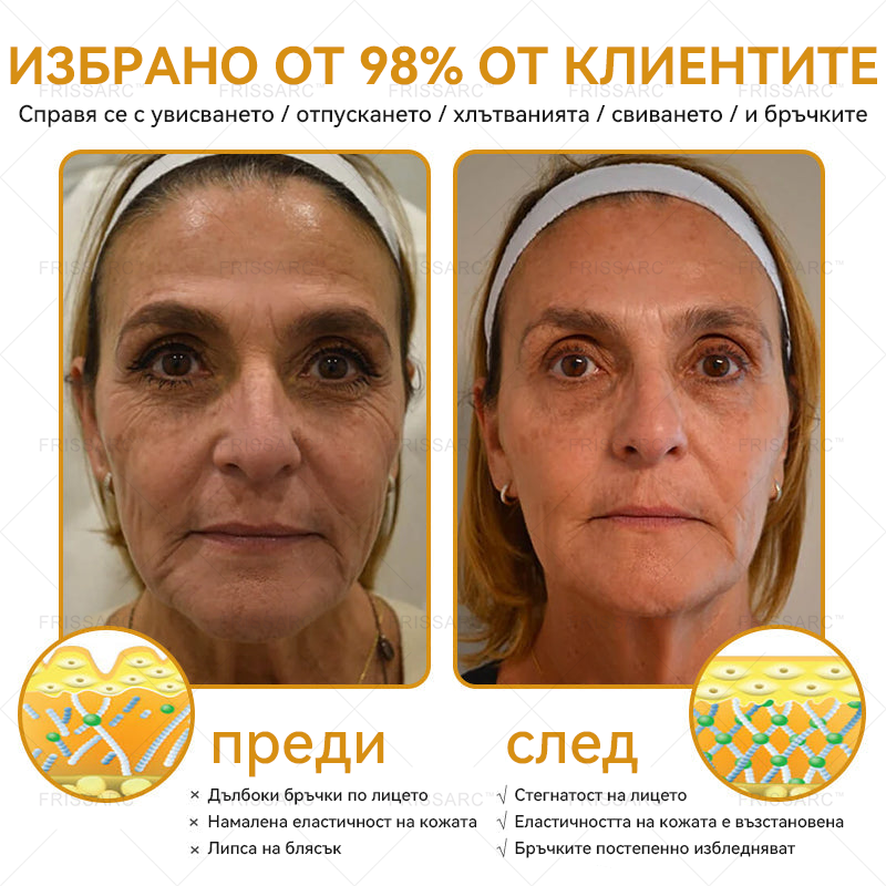 FrissArc™ Крем против бръчки с пептиди от пчелна отрова – Намалява бръчките, стяга кожата и изравнява тена.