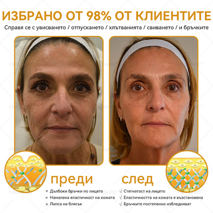 FrissArc™ Крем против бръчки с пептиди от пчелна отрова – Намалява бръчките, стяга кожата и изравнява тена.