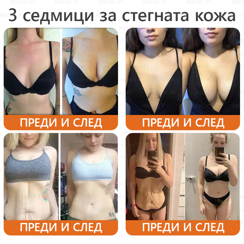 REHELY® Крем с пчелна отрова за регенерация на кожата – Подходящ за всички възрасти и типове кожа)