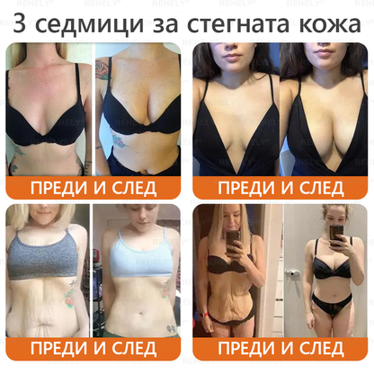 REHELY® Крем с пчелна отрова за регенерация на кожата – Подходящ за всички възрасти и типове кожа)