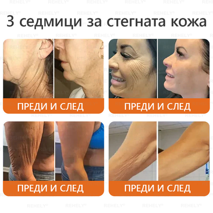 REHELY® Крем с пчелна отрова за регенерация на кожата – Подходящ за всички възрасти и типове кожа)