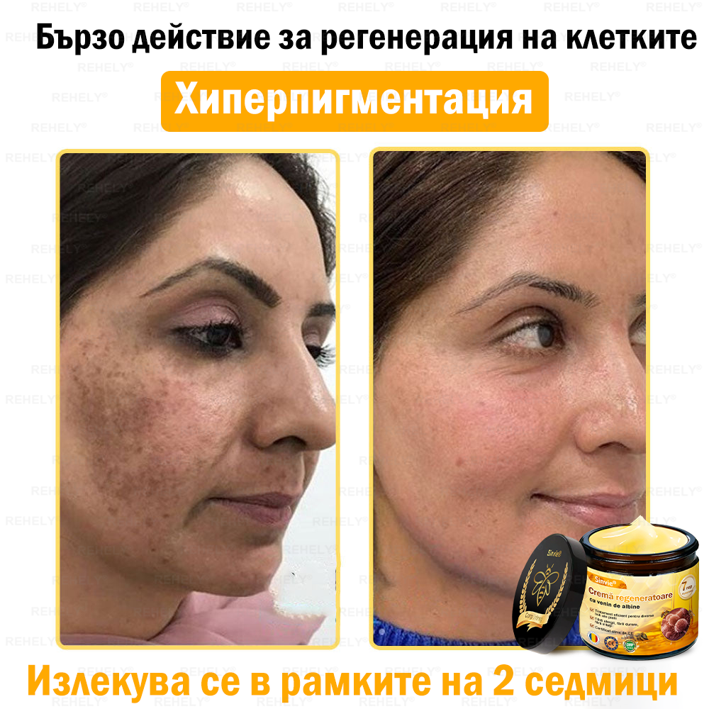 REHELY® Крем с пчелна отрова за регенерация на кожата – Подходящ за всички възрасти и типове кожа)