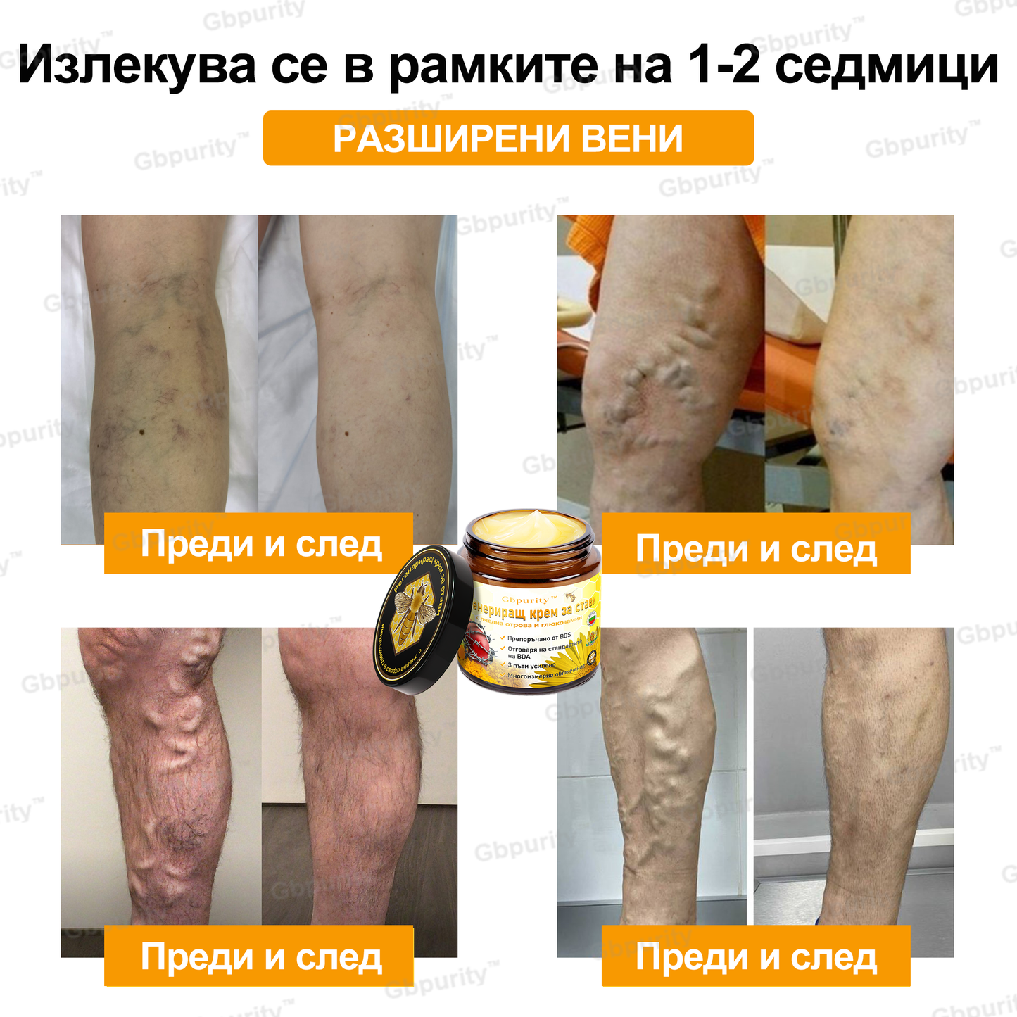 🦴𝑮𝒃𝒑𝒖𝒓𝒊𝒕𝒚™ Регенериращ крем за стави с пчелна отрова и глюкозамин — Препоръчан от водещи специалисти от Българската асоциация по ортопедия и травматология