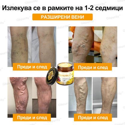 🦴𝑮𝒃𝒑𝒖𝒓𝒊𝒕𝒚™ Регенериращ крем за стави с пчелна отрова и глюкозамин — Препоръчан от водещи специалисти от Българската асоциация по ортопедия и травматология