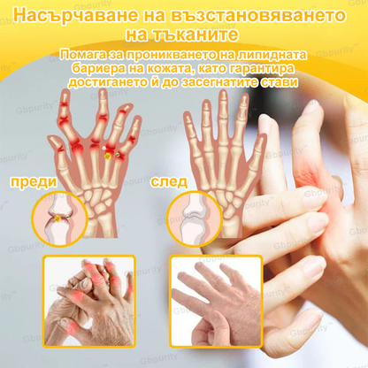 🦴𝑮𝒃𝒑𝒖𝒓𝒊𝒕𝒚™ Регенериращ крем за стави с пчелна отрова и глюкозамин — Препоръчан от водещи специалисти от Българската асоциация по ортопедия и травматология