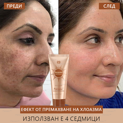 Parowu™ Изсветляваща и премахваща петна маска (✨Натурални съставки за дълготрайно премахване на петна, хиперпигментации и слънчеви петна)