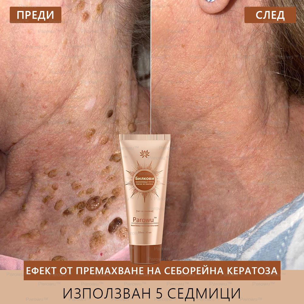 Parowu™ Изсветляваща и премахваща петна маска (✨Натурални съставки за дълготрайно премахване на петна, хиперпигментации и слънчеви петна)