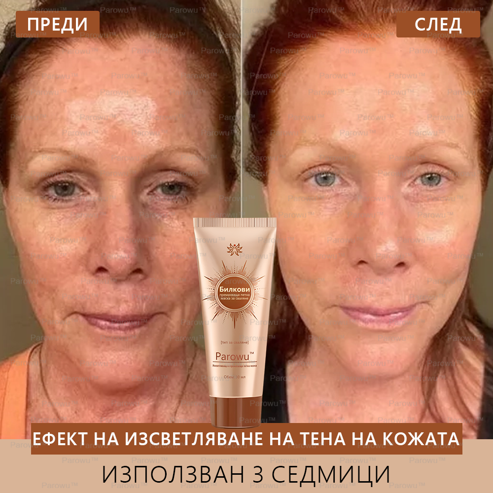 Parowu™ Изсветляваща и премахваща петна маска (✨Натурални съставки за дълготрайно премахване на петна, хиперпигментации и слънчеви петна)