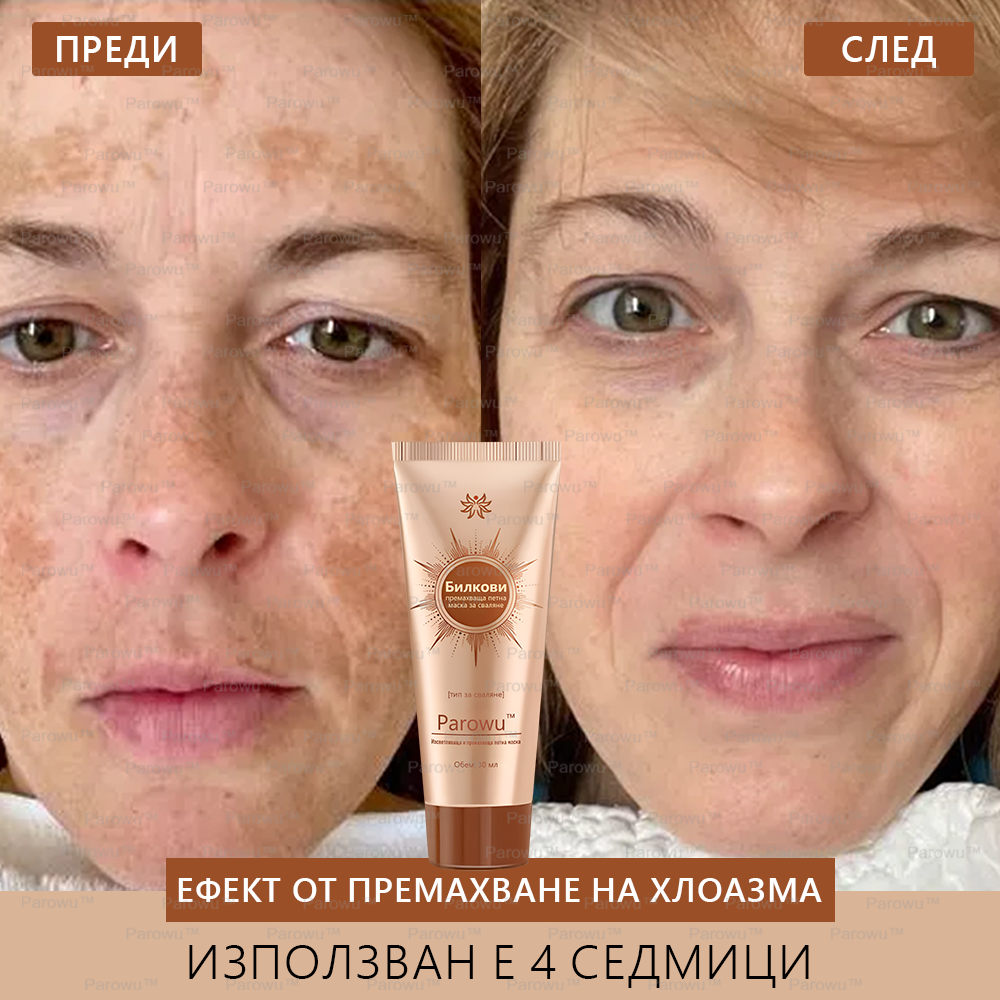 Parowu™ Изсветляваща и премахваща петна маска (✨Натурални съставки за дълготрайно премахване на петна, хиперпигментации и слънчеви петна)